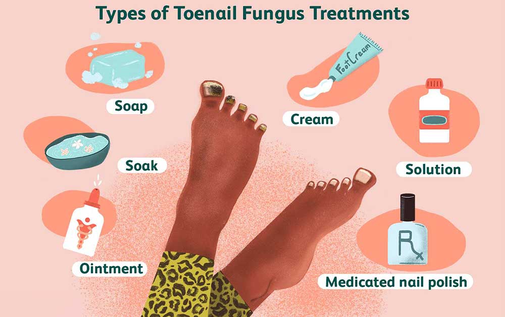 preprecevanje_glivic